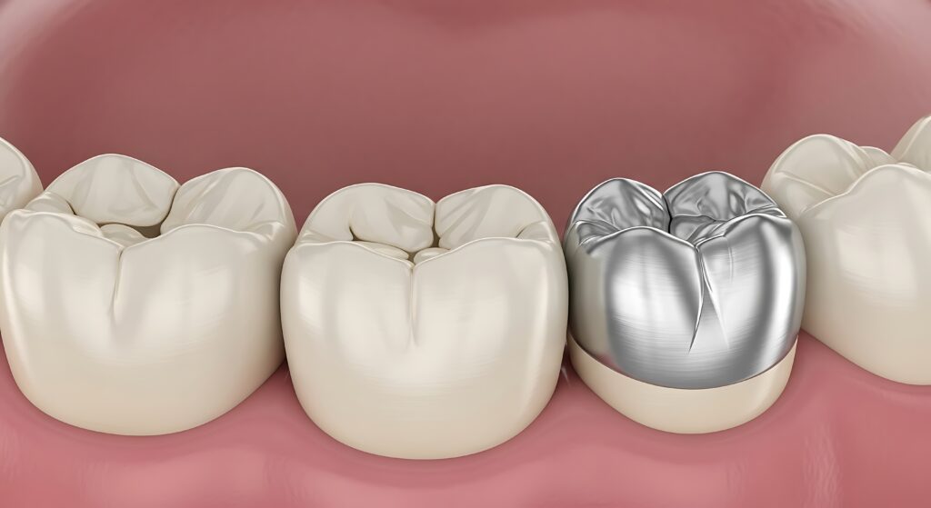 歯科医師が「短命」な理由。削り取られるアマルガムと水銀汚染の真実